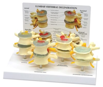 Four Stage Vertebrae Model with Base